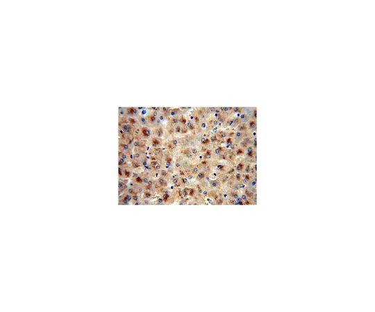 62-8457-94　［Discontinued］Anti-FETUB　ABC388