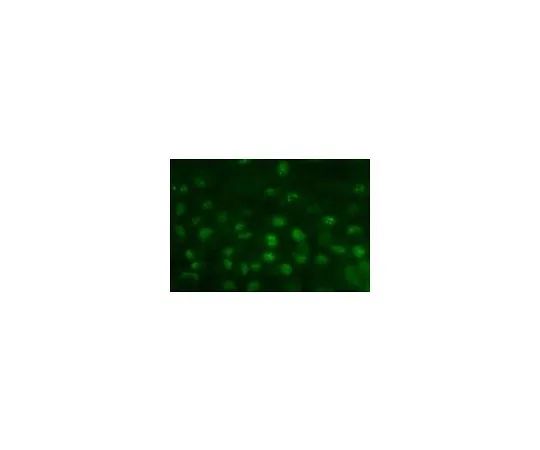 62-8490-70　［Discontinued］Anti-Nucleoli, clone 125-10; 100 μL　MAB1277