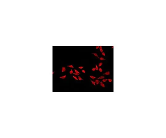 62-8520-28　［Discontinued］Anti-ATG7, clone EPR6251, Rabbit Monoclonal　MABN1124