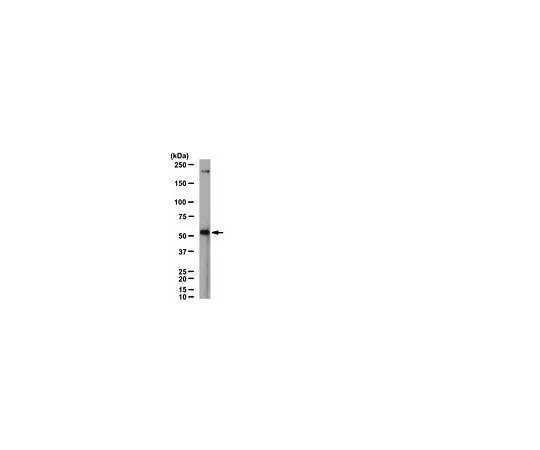 62-8455-11　［Discontinued］Anti-Nicotinic Acetylcholine Receptor α6; 100 μg　AB15324