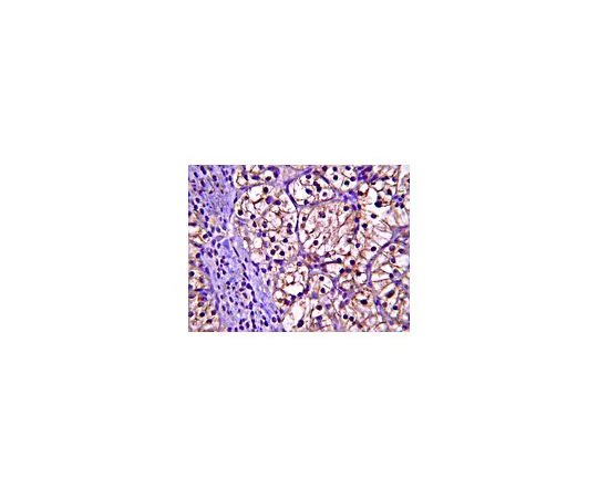 62-8454-02　［Discontinued］Anti-Ubiquitin-conjugating enzyme E2 N; 100 μg　AB10025