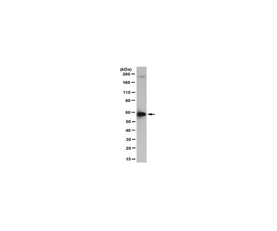 62-8517-04　［Discontinued］Anti-MAO-A Antibody, clone 15E12.1,　MABN230