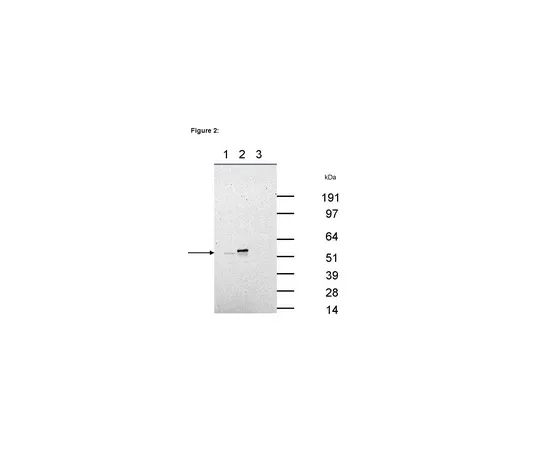 62-8367-50　［Discontinued］RIPAb+(TM) Hexim 1; 10 assays　03-177
