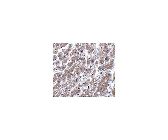 62-8459-84　［Discontinued］Anti-MATN1　ABD131