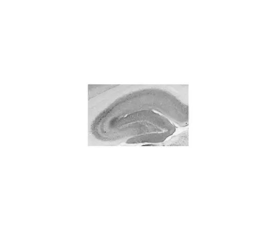 62-8518-07　［Discontinued］Anti-GABA(B)R2 Protein Antibody, clone N81/2 MABN488　MABN488