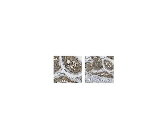 62-8467-30　［Discontinued］Anti-PPX　ABN461