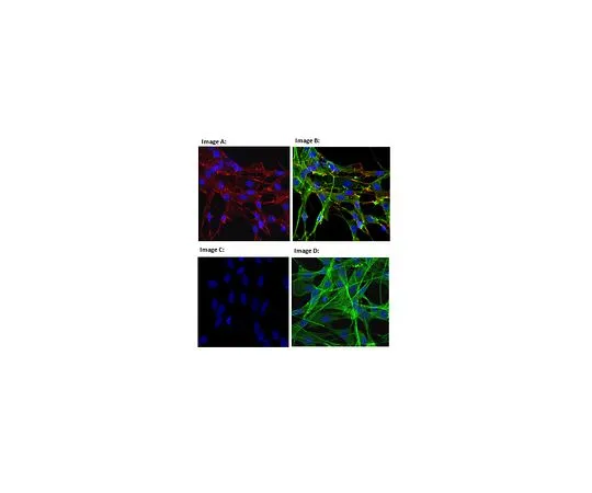 62-8473-46　［Discontinued］Anti-phospho-Lamellipodin/RAPH1 (Tyr426)　ABT279