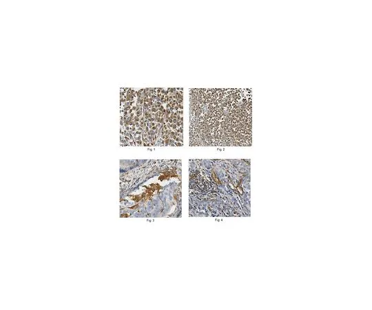 62-8457-59　［Discontinued］Anti-CIP2A　ABC307