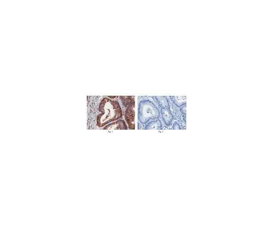 62-8461-08　［Discontinued］Anti-SMYD3 Antibody　ABE315