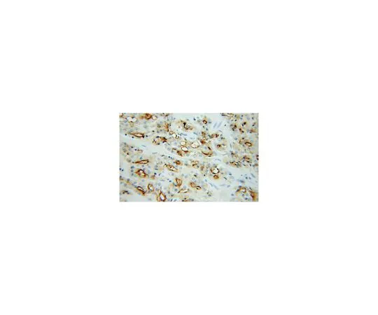 62-8457-44　［Discontinued］Anti-FOLH1　ABC279