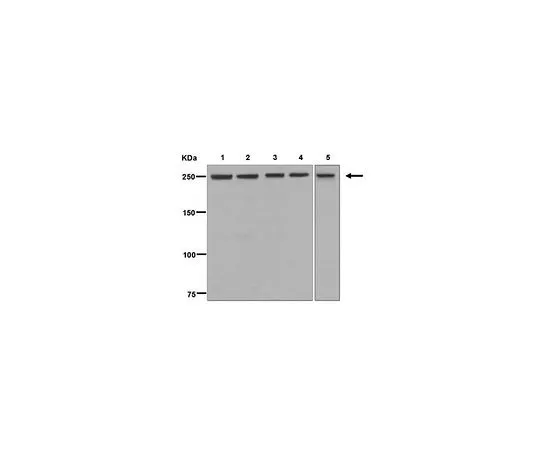 62-8523-56　［Discontinued］Anti-mTOR/FRAP, clone EPR390(N), Rabbit Monoclonal　MABS799