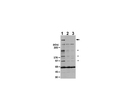 62-8468-05　［Discontinued］Anti-Sacsin Antibody　ABN1019