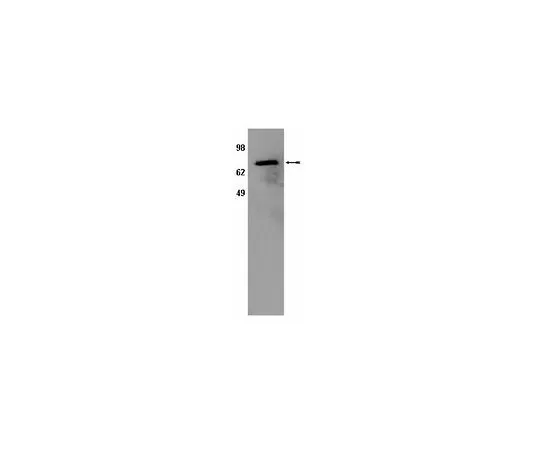 62-8454-21　［Discontinued］Anti-POR; 50 μL　AB10301