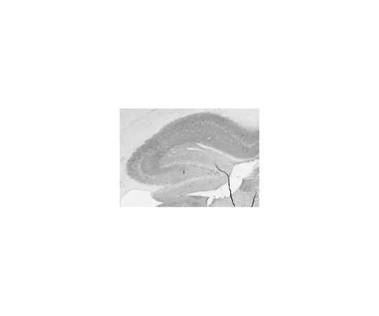 62-8518-08　［Discontinued］Anti-GABA(A)R, Alpha1 Protein Antibody, clone N95/35 MABN489　MABN489