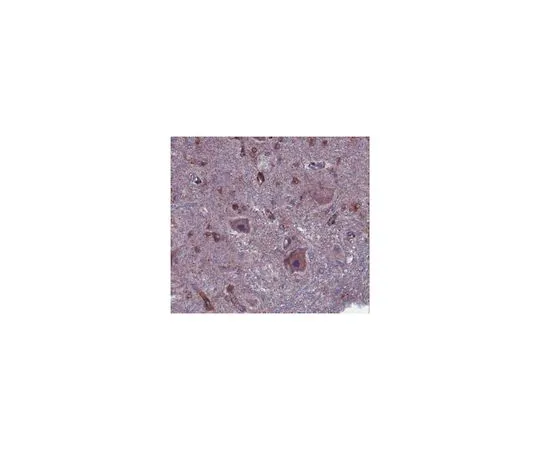 62-8465-79　［Discontinued］Anti-Tau-tubulin kinase 2 (TTBK2); 100 μg　ABN103