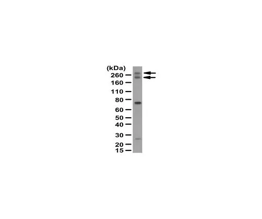 62-8460-75　［Discontinued］Anti-TDRD6　ABE231