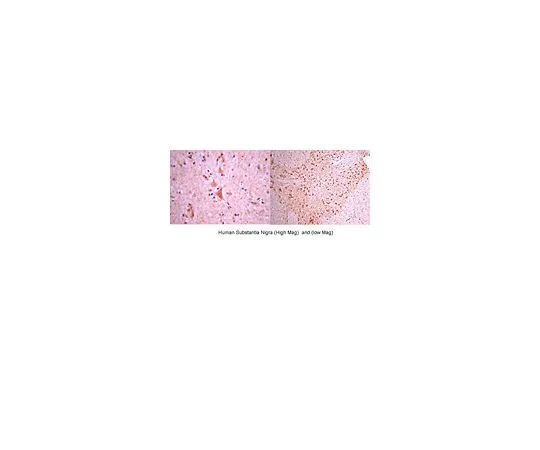 62-8446-59　［Discontinued］Anti-Melanin Concentrating Hormone; 100 μg　AB2258