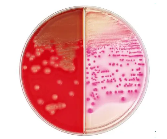 63-6527-84 BD BBL (TM) TSAII 5% sheep blood agar/McConkey II agar 20 sheets 251290