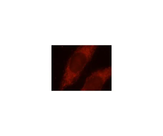 62-8467-68　［Discontinued］Anti-AKAP1　ABN510