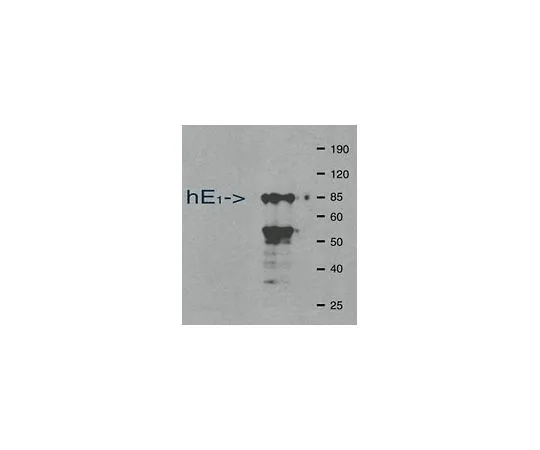 62-8495-17　［Discontinued］Anti-Ubiquitin Activating Enzyme E1, clone 2G2.3; 100 μg　MAB3520