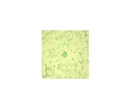 62-8475-35　［Discontinued］Anti-Caspase-3 (Ab-4) Mo*** mAb (AM1.31-11)　AM65-100UG