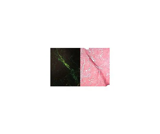 62-8535-06　［Discontinued］ISOSLIDE(R) Congo Red Control Slides with reference tissue for the detection of amyloid structures in histological tissue　1.02561.0001