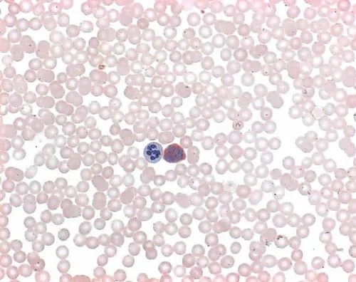 61-0314-64　［Discontinued］LEUCOGNOST(R) EST Detection Of Leukocyte Alpha-Naphthyl Acetate Esterase Activity 116301 12Units　1.16301.0002
