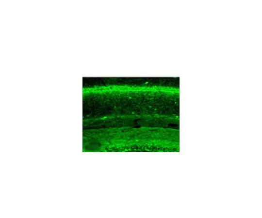 62-8411-40　［Discontinued］Anti-Cannabinoid Receptor CB1 (1-77) Rabbit pAb　209550-100UL