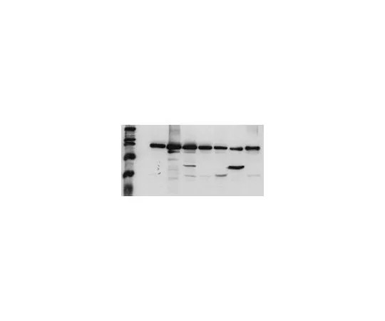 62-8417-61　［Discontinued］PhosphoDetect(TM) Anti-Epidermal Growth Factor Receptor (pTyr1173) Mo*** mAb (9H2)　324864-1SET