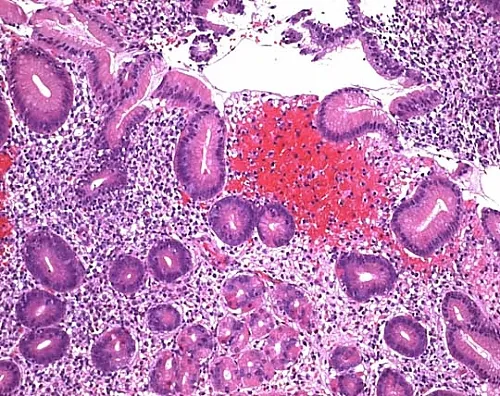 61-0314-12　［Discontinued］Eosine B (Eosin Blue) (C.I. 45400) for Microscope Certistain 115934 100G　1.15934.0100