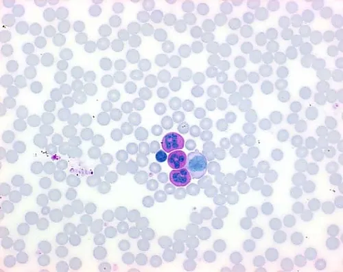 61-0314-65　［Discontinued］LEUCOGNOST(R) PAS Detection Of Leukocyte PAS Reaction 116302 12Units　1.16302.0002