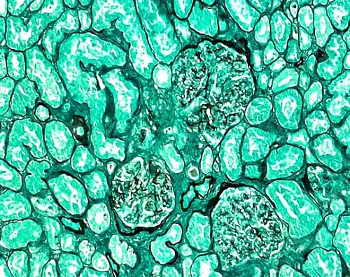 61-0314-25　［Discontinued］Light Green Yellow SF (C.I. 42095) for Microscope Certistain 115941 100G　1.15941.0100