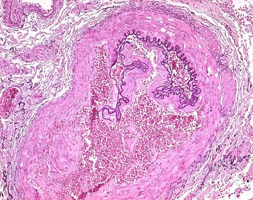 61-0314-17　［Discontinued］Fuchsine (Basic) (C.I. 42510) for Microscope Certistain 115937 25G　1.15937.0025