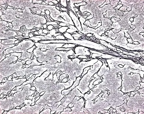 61-0286-75　［Discontinued］ISOSLIDE(R) Reticulin Control Slide for Histology with Reference Tissue for The Detection Of Reticular Fiber 100361 25Slides　1.00361.0001