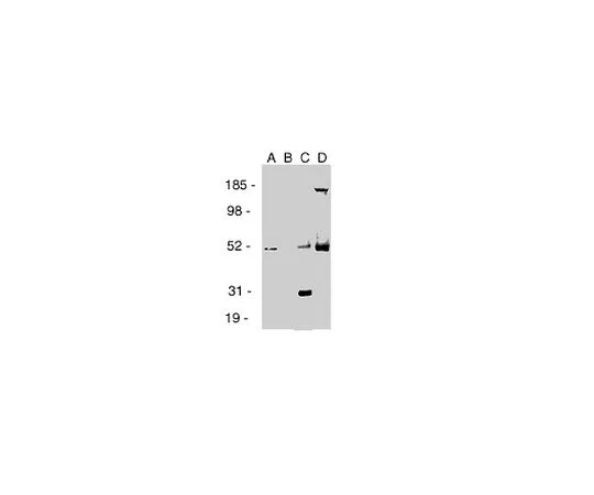 62-8487-43　［Discontinued］Anti-Estrogen Receptor β (Ab-2) Mo*** mAb (9.88)　GR39-100UL