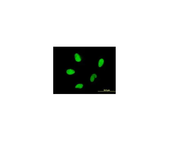 62-8481-39　［Discontinued］Anti-HMGA2 Mo*** mAb (2D10)　DR1073-100UG