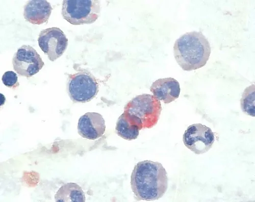 61-0314-67　［Discontinued］LEUCOGNOST(R) AP Detection Of Leukocyte Acidic Phosphatase Activity LEUCOGNOST(R) 116304 12Units　1.16304.0002