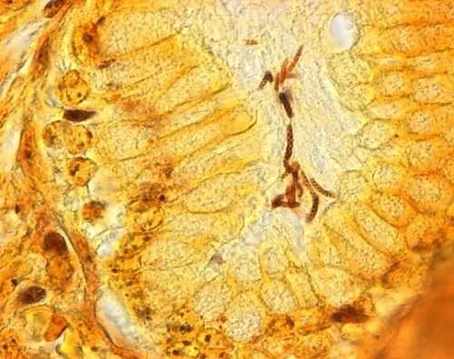 61-0292-32　［Discontinued］Warthin-Starry Stain Kit Modified Method for Detecting Helicobacter Pylori in Paraffin Pieces 102414 1ST　1.02414.0001