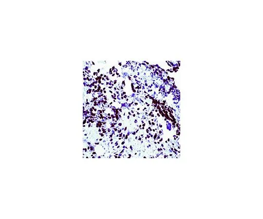 62-8478-61　［Discontinued］Anti-Wilm's Tumor Protein Rabbit pAb　CA1026-50UL