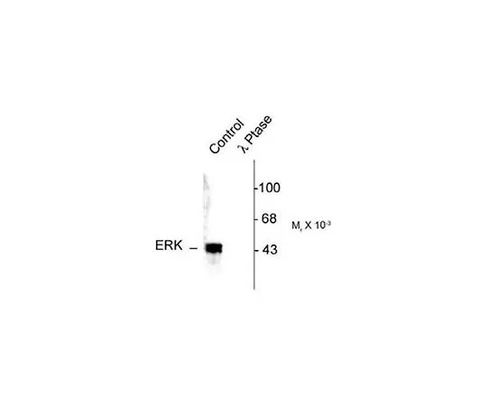 62-8427-38　［Discontinued］PhosphoDetect(TM) Anti-MAP Kinase ERK1/ERK2 (pThr202/Tyr204) Rabbit pAb　442685-100UL