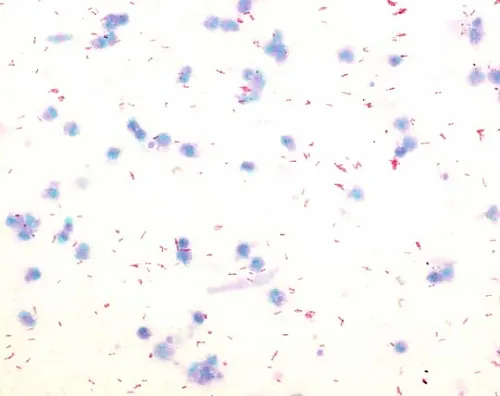 61-0314-26　［Discontinued］Malachite Green (Oxalate) (C.I. 42000) for Microscope Certistain 115942 25G　1.15942.0025