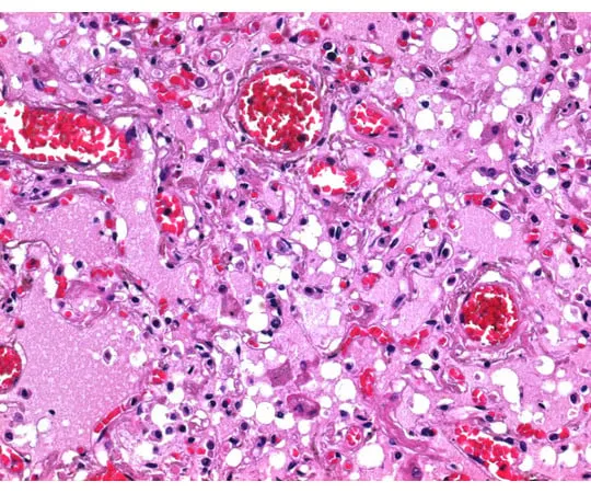 61-0302-05　［Discontinued］Paraffin (Pellets Type) Congealing Point 56 - 58℃, for Histology 107164 2.5kg　1.07164.2500