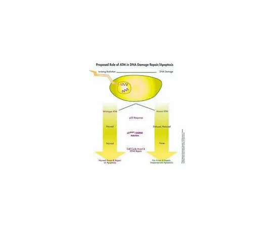 62-8529-65　［Discontinued］Anti-ATM (Ab-3) (819-844) Rabbit pAb　PC116-100UG